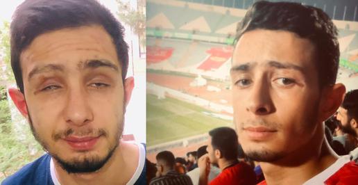 Hossein Naderbeigi was a bystander who lost both eyes after being shot at close range by a member of paramilitary Basij force