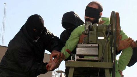 حکم قطع دست یک زندانی در اوین اجرا شد