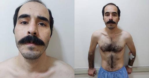 حسین رونقی به روایت عکس‌هایی پس از ۶۴ روز اعتصاب غذا