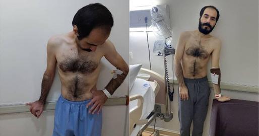 حسین رونقی به روایت عکس‌هایی پس از ۶۴ روز اعتصاب غذا