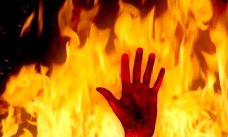 درگذشت زنی که در پیرانشهر توسط همسرش به آتش کشیده شد