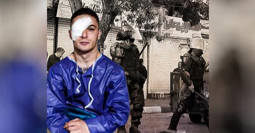 And as 23-year-old Ali Zare, who also lost his right eye during protests, stated on social media: “My eye for a free Iran”