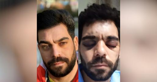 «علی طاحونه» یکی از آسیب دیدگان از ناحیه چشم است؛ مرد جوانی که نیروهای سرکوب در شهر «کرج» او را هدف شلیک‌های پیاپی قرار دادند و وقتی خیال کردند که علی کشته شده است، آن بن‌بست خونین را ترک کردند
