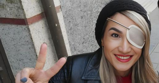 Blinding as a Weapon (53): “Beauty Lies in Differences”