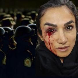Mercedeh Shahinkar’s eye was seriously injured on October 15, 2022, while standing next to her mother who had been shot in the leg a week earlier