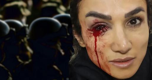 Take 34-year-old fitness instructor Mercedeh Shahinkar, who lost most of her sight in one eye during protests. She described the injury — which still caused her pain months later — as “a badge of honor.”