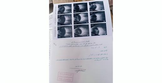 نعمت از بازداشت که خارج شد، نتوانست جراحی کند. یک‌بار به بیمارستان «فارابی» تهران مراجعه کرده بود اما جواب مبهمی به او داده بودند؛ انگار که دیگر فایده‌ای نداشته است، ناامید شده و دل از درمان بریده بود، کارش را هم از دست داده بود و توانایی پرداخت عمل‌های جراحی را نداشت