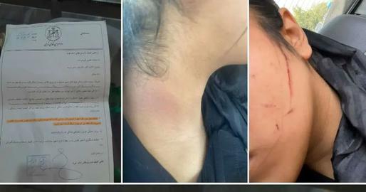 مادر نفس حاجی‌شریف: برای تذکر رعایت حجاب چرا لباس دخترم پاره شد؟