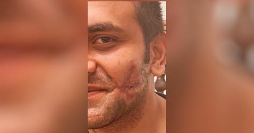 Oficiales de policía iraníes arrestados en caso de tiroteo contra manifestante