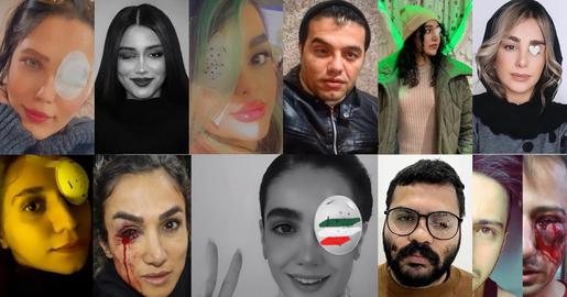 این گزارش، تلاشی است برای ثبت بخش کوچکی از این جراحات و آسیب‌ها بر چشم معترضان و رهگذران در اعتراضات اخیر در ایران.