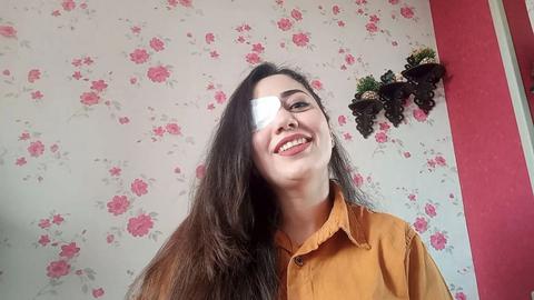 «کوثر خشنودی‌‌کیا»، ملی‌پوش تیم ملی تیروکمان زنان ایران، خبر از دست دادن یک چشمش را به دلیل شلیک مستقیم نیروهای حکومتی منتشر کرد