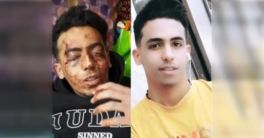A plainclothesman fired at Ghobadi’s face. While blood was running down his face, the teenager tried to escape but the security forces shot him multiple times in the back and filled his body with pellets