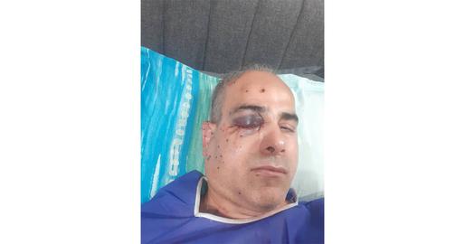 Bahareh sat beside Ali in the front seat, and as the windows shattered, the sound of Respina's screams reverberated in their ears