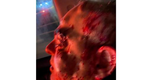 Bahareh turned around to see her husband slumped behind the steering wheel, covered in blood, saturated in screams