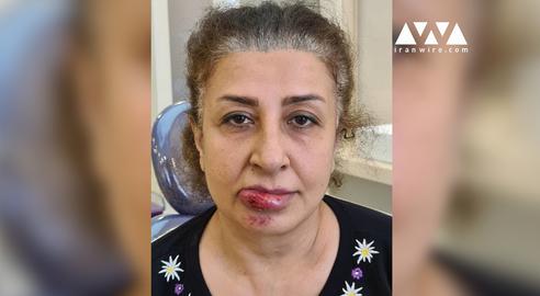 دکتر شیرین فرقانی: ماموران سرکوب بی‌هدف به سمت من شلیک کردند