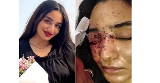 Iranian University Student Recalls Smile Of Police Who Shot Her In The Face