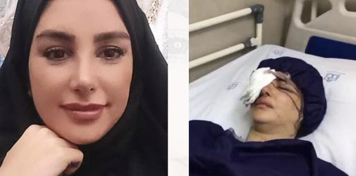 Elaheh Tavakolian, before and after her injury