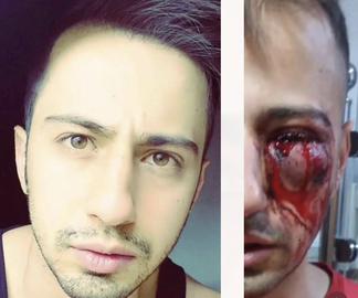 Saman, before and after his injury