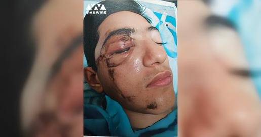"My son Arman was grabbed by one arm and dragged along the ground as if he were a sack being hauled away. They savagely beat his head, face, and flank, nearly rendering him unconscious. Bystanders had to intervene to free him from the clutches of the police"