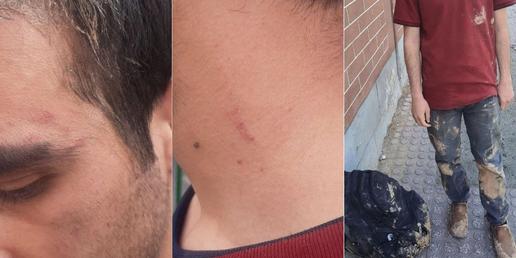 ضرب و شتم یک فعال دانشجویی دانشگاه علم و صنعت توسط حراست