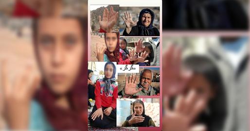 تصاویری از شهروندانی که گفته می‌شود انگشتان دست‌هایشان در اثر استفاده از گُرگُر قطع شده است.