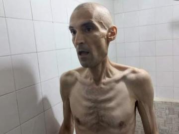 Shocking Photos Show Emaciated Jailed Iranian Activist On Hunger Strike