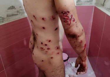 انتشار تصاویری از شش ماه خشونت نهادهای امنیتی برای سرکوب معترضان