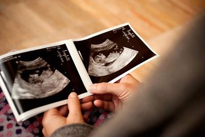 براساس دستورالعمل جدید ابلاغ شده توسط وزارت بهداشت مباشرت یا معاونت در سقط جنین در ایران «جرم‌انگاری» شده و برای مرتکبان «جریمه سنگین» تعیین شده است.
