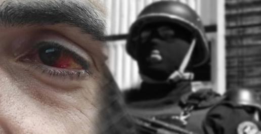 Blinding As A Weapon (5): Fearful Protester Shot In Eye Continues Fight For Justice