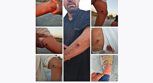 Images of villagers' rubber bullet wounds on being set upon by trucks and riot police surfaced online, but were rubbished by the authorities