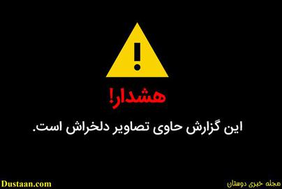 روایت قتل کارگر افغانستانی در ایران؛ با بدنی پر از ساچمه، جان داد؛ قاتل آزاد شد