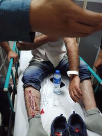 An injured Hepco worker who was beaten by anti-riot police