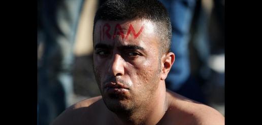 پناهجویان ایرانی لب‌هایشان را در مرز یونان دوختند