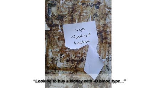 Iran's Real Emerging Market: Kidneys