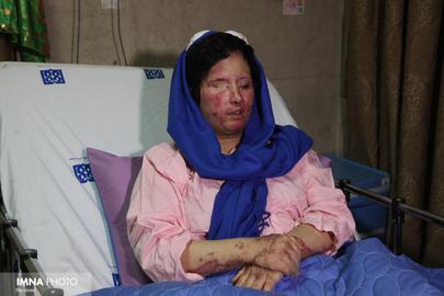 سهیلا جورکش یکی از قربانیان اسیدپاشی اصفهان است. پدر سهیلا جورکش می‌گوید: «...حجاب روسری نیست، حجاب عدم تجاوز به حقوق دیگران است و پی‌گیری اختلاس‌های فراوانی که جامعه را زیر و رو کرده است.»