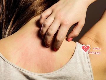 به تازگی تحقیق جدیدی انجام شده است که به‌ طور شفاف‌تری از ارتباط بین اشکال مختلف حساسیت و اختلالات و بیماری‌های روانی صحبت می‌کند.