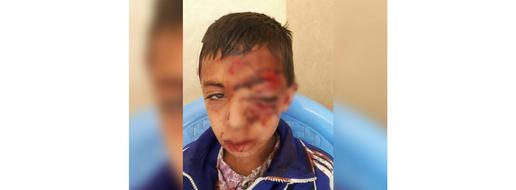 سقوط دانش‌آموز روستایی از کوه در راه دسترسی به شبکه شاد