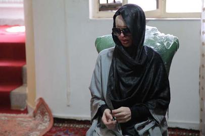 معصومه جلیل پور، قربانی اسیدپاشی در تبریز؛ هیچ یک از وعده های مسئولین عملی نشد