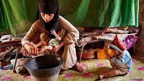 تولد ۱۳۴۶ نوزاد از مادران کمتر از ۱۵ سال در ایران