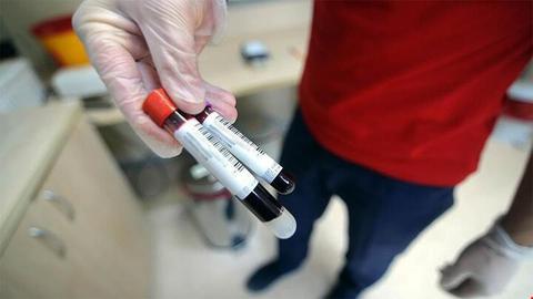 آنفلوآنزا جان ۵۶ نفر را در ایران گرفت