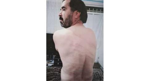 Rafie was subjected to 74 lashes in Greater Tehran Central Penitentiary on November 23, in the presence of two officers, and could not sleep for days from the pain