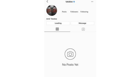 Amir Tataloo's Instagram page was closed at the same time as a media campaign was mounted against him by the Kandoo and article-19 non-profit organizations