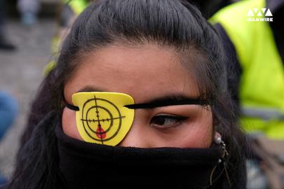 French protester with a symbolic eyepatch (Picture by Alfred Yaghobzadeh)