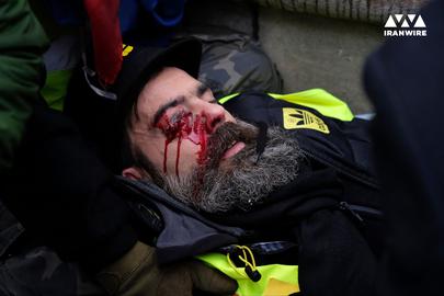 Alfred Yaghobzadeh’s picture of Jérôme Rodrigues, a Yellow Vests protester who lost an eye in Paris in 2018