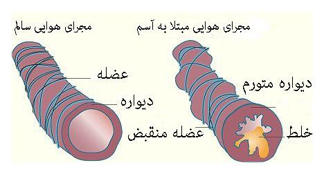 نگهداری از سگ و گربه آسم کودکان را کاهش می‌دهد